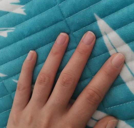 化疗后为什么指甲变长了,化疗后指甲凹凸不平什么原因