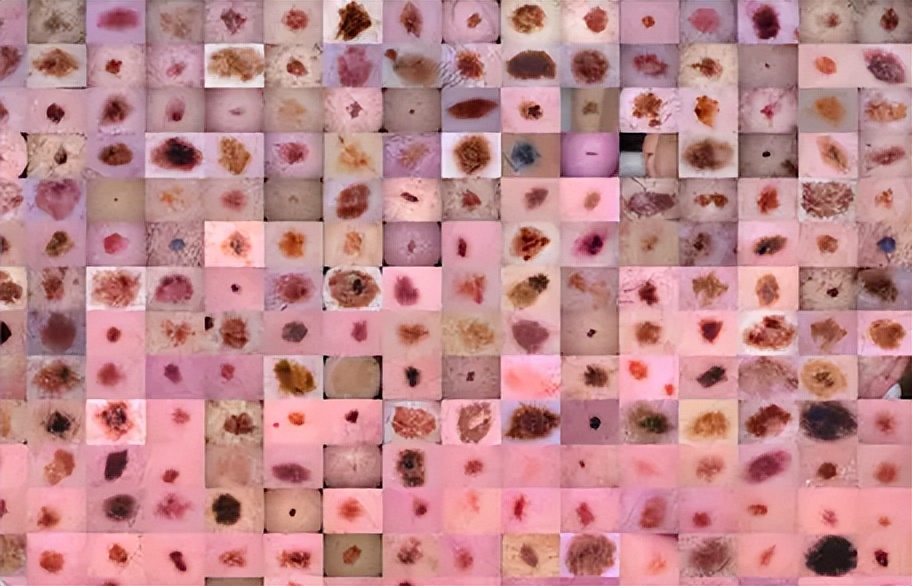 60+开源数据集资源大合集（医学图像、卫星图像、自动驾驶等）