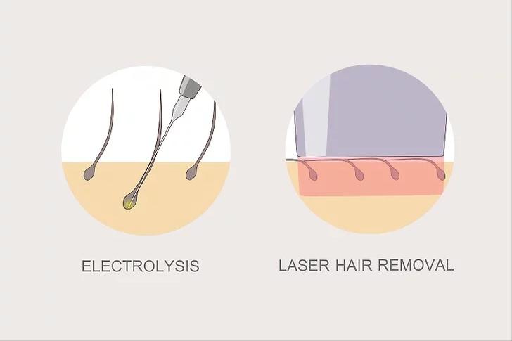 女性怎么调理不长体毛,女生体毛茂盛长胡子怎么办