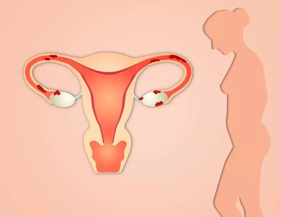 不起眼的五个行为正在毁掉你的肾,6个不起眼的习惯正在伤害眼睛