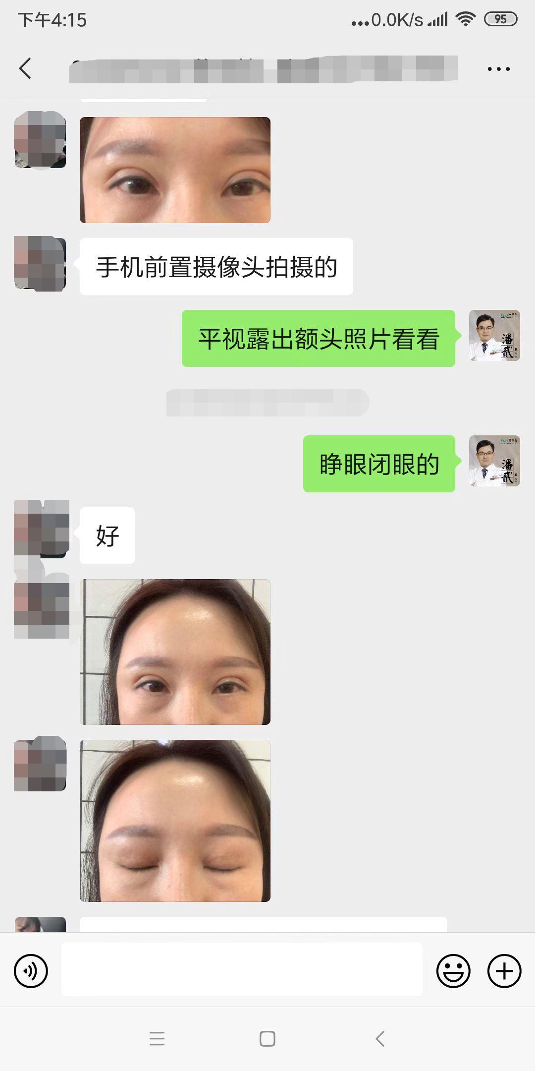 整容失败大眼女,整容12次失败之后长什么样