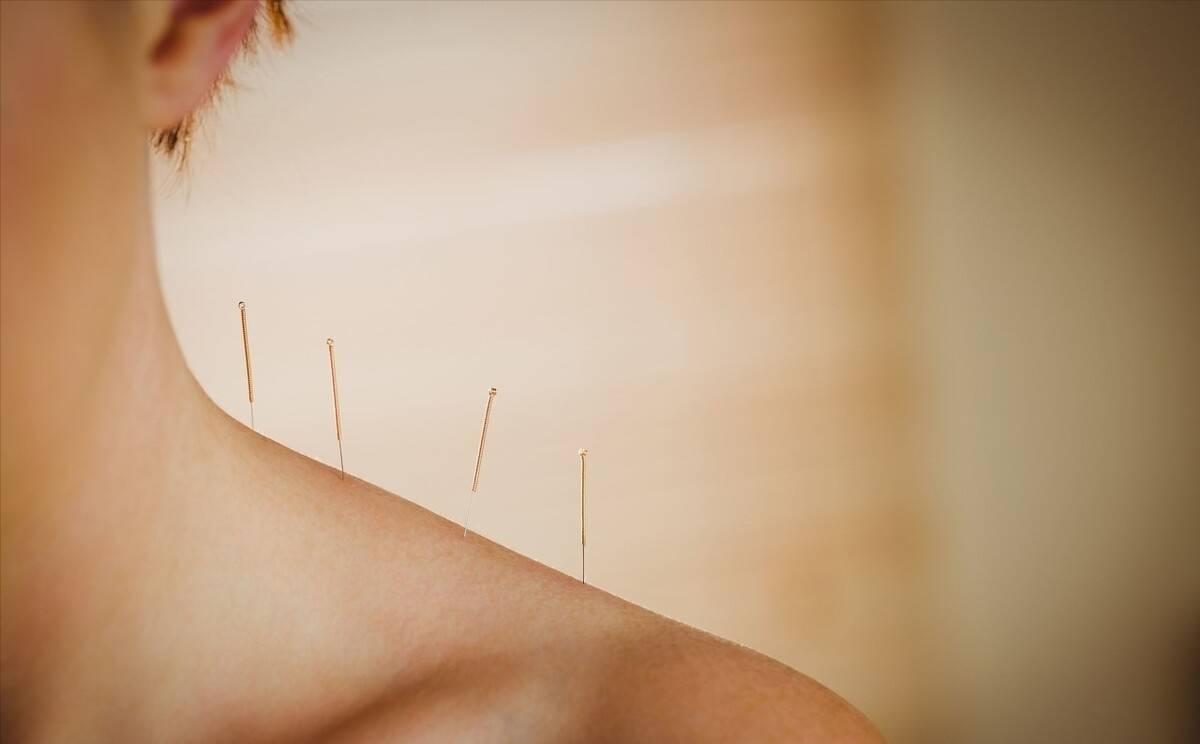 中医针灸治疗腰痛病的学术思想,古法针灸临床治验