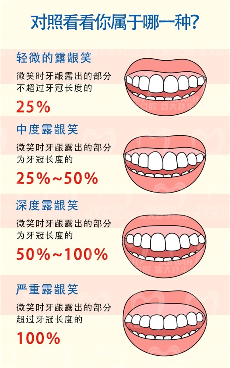 有一种“颜值杀手”叫露龈笑，这种情况该如何应对？