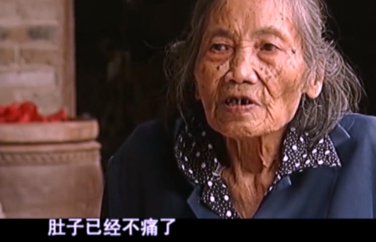 2007年四川90岁老妇，腹中怀子60年未生，后检查发现胎儿没有腐烂