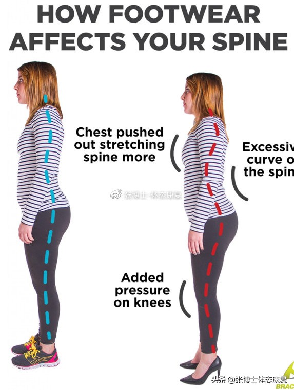 「体态康复」缓解下背痛的十六条建议