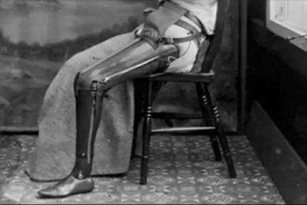 幻肢、恋足是心理出现问题吗？这些行为的背后大脑都有解释