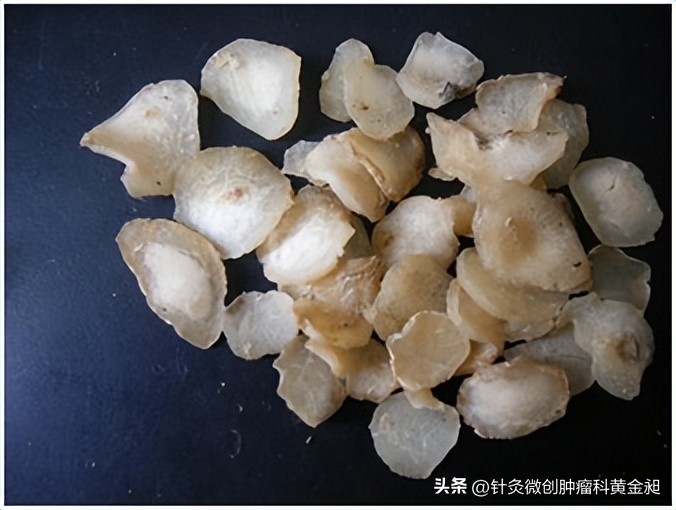 儿童颈部淋巴结怎么消除,放疗能消除颈部淋巴结吗