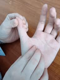 中风偏瘫半身发硬是怎么回事,中风偏瘫以后手老是没力该怎么办