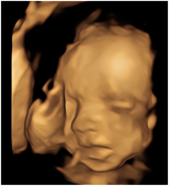 科普视频产检到底检什么,产检四维是检查什么