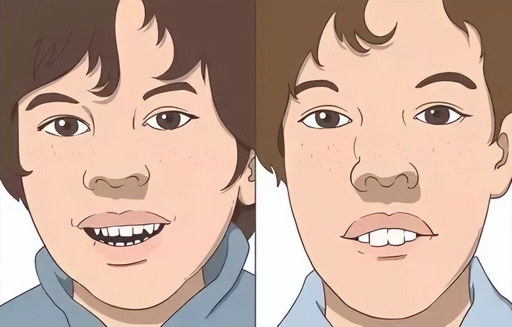 孩子扁桃体发炎引起声音嘶哑,孩子扁桃体发炎嗓子痒老咳怎么办