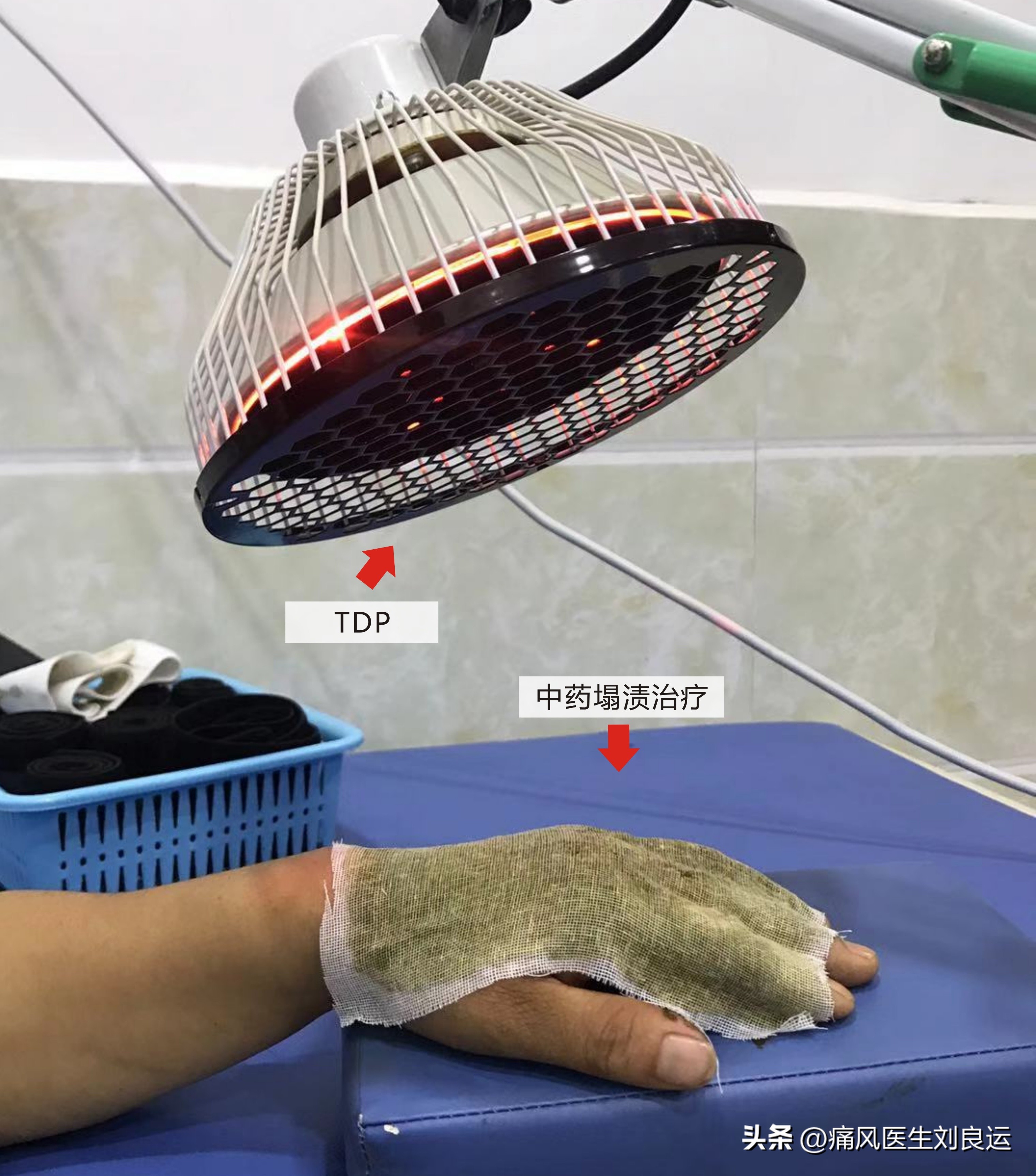 痛风病人用什么方法能治好痛风,痛风治疗最好的方法有什么