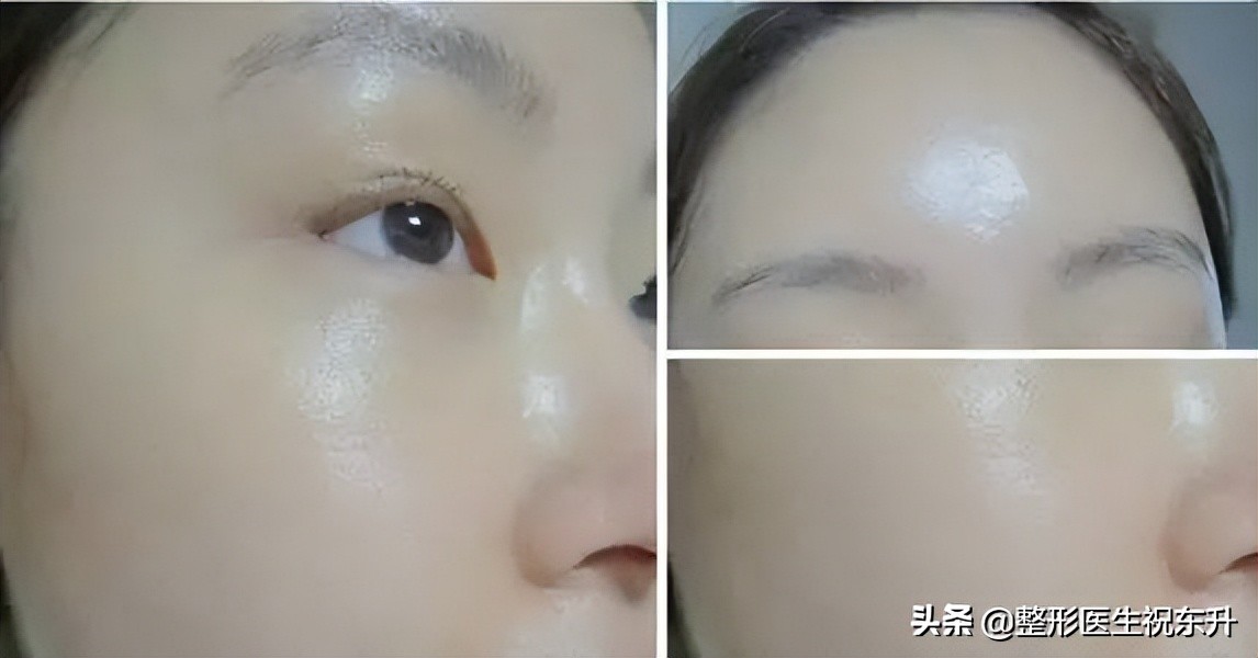 想做水光不知道怎么搭配,做水光针需要什么资质