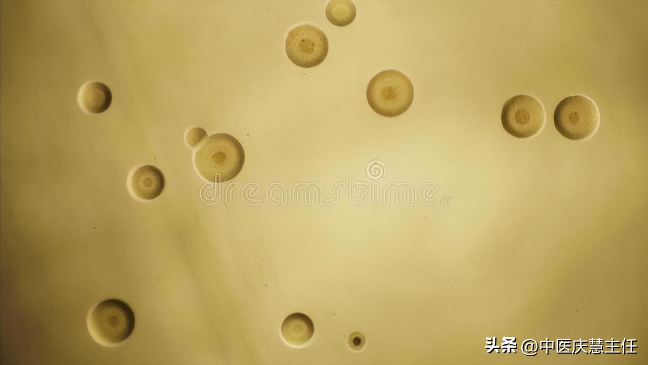 解脲支原体阳性可以中医调理吗,解脲支原体阳性是湿气重吗