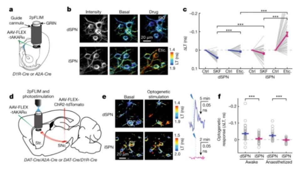 为治疗帕金森病带来新方法，北大发现大脑控制运动的“刹车”机制