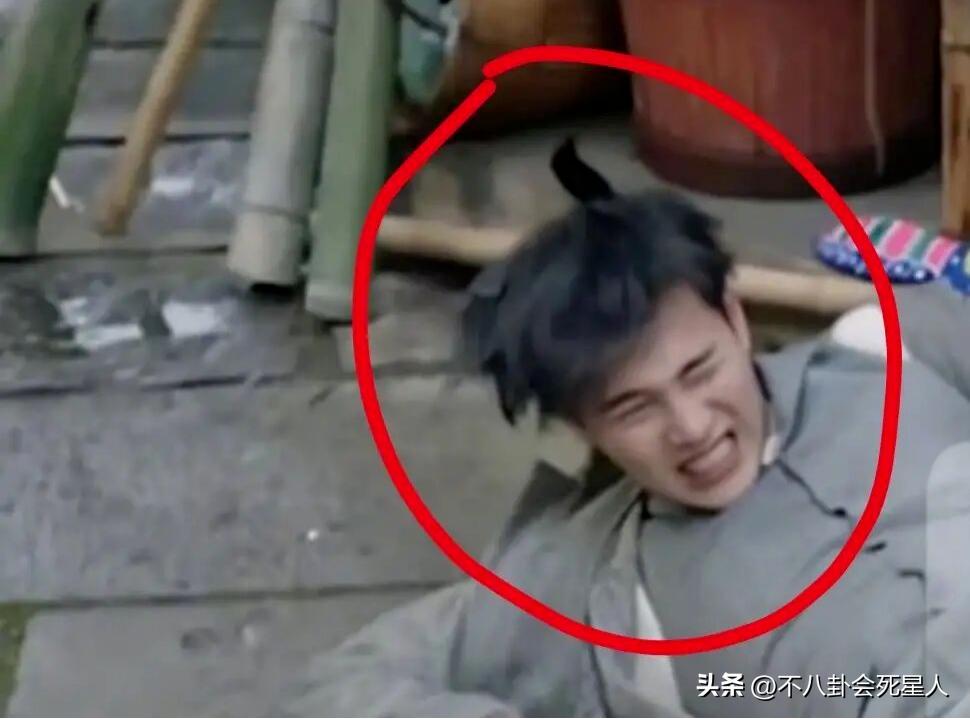 假双眼皮的明星,明星的假脸