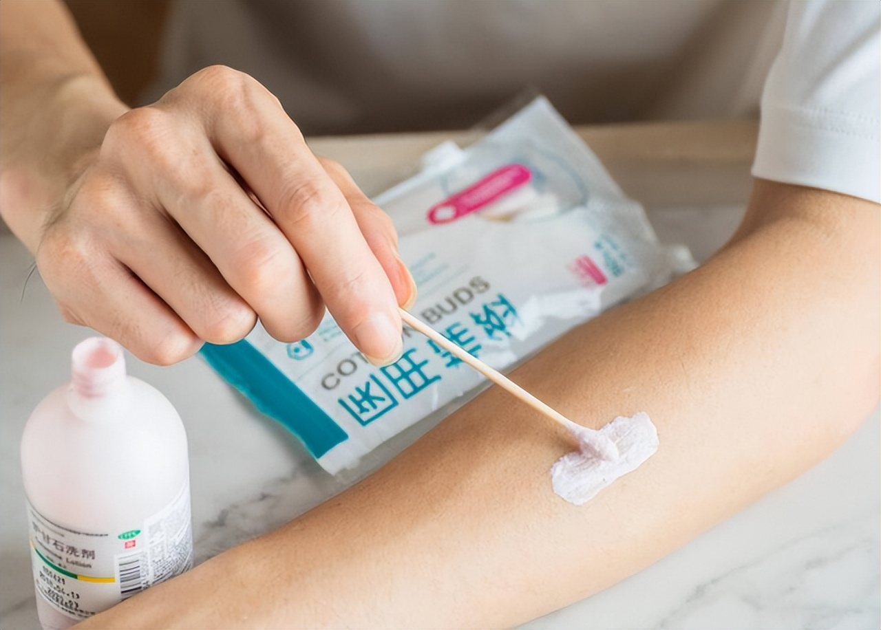 炉甘石洗剂现在要15元一瓶吗,炉甘石洗剂一瓶价格