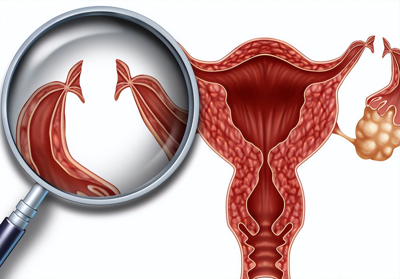 女生每天都清洗*裤内**，为何中间还是发黄发硬呢？看完就明白了