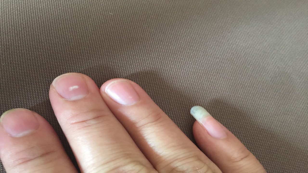 为什么有的人是两个小脚趾甲,小脚趾甲长得小是什么血统