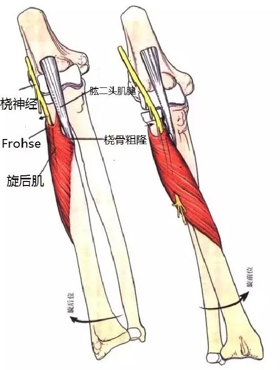手腕抬不起来什么原因如何治,肱骨骨折手腕抬不起来怎么治