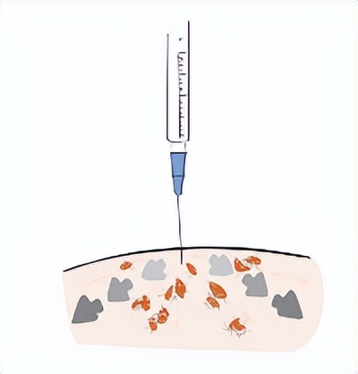 美丽守卫战,美丽保卫战