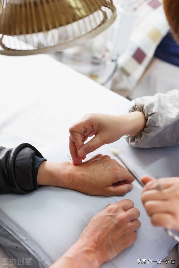 三叉神经止痛三穴,三叉三穴是不是对侧取穴