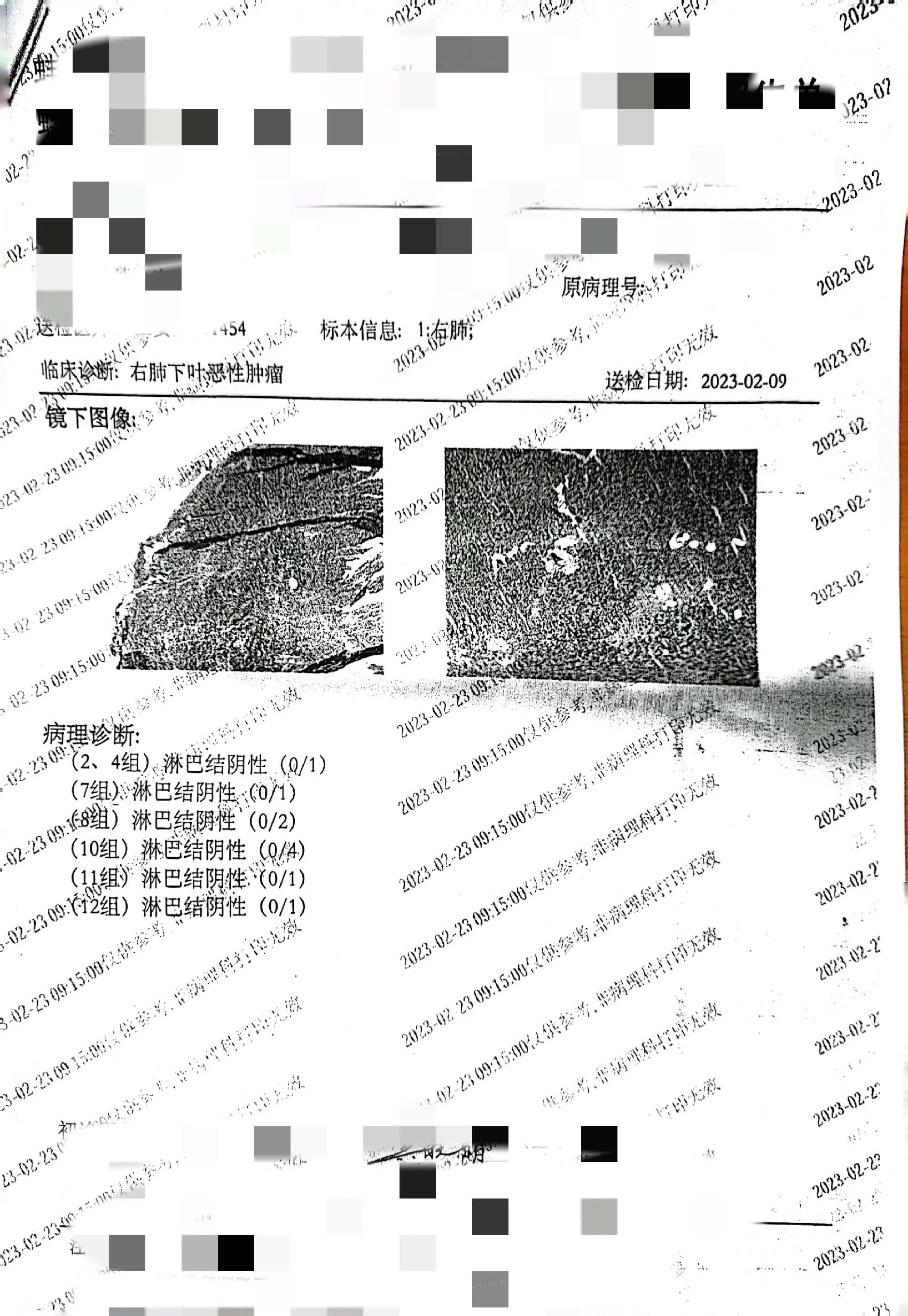 妈妈确诊早期肺癌的病理情况、基因检测及治疗进程经验分享