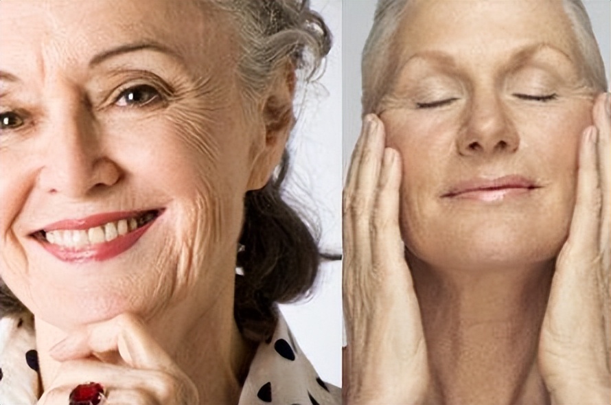 年轻人的老年斑为什么越来越大,为什么有的人老年斑特别多