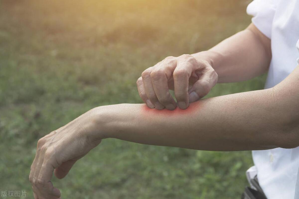 夜里皮肤痒，多因血燥！这张方子，滋阴养血，祛风止痒，巧妙化解
