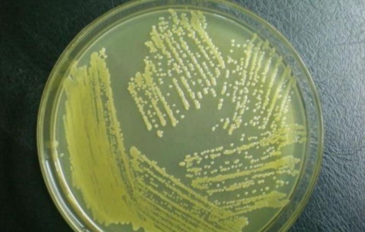 切尔诺贝利抗辐射真菌,切尔诺贝利发现的真菌