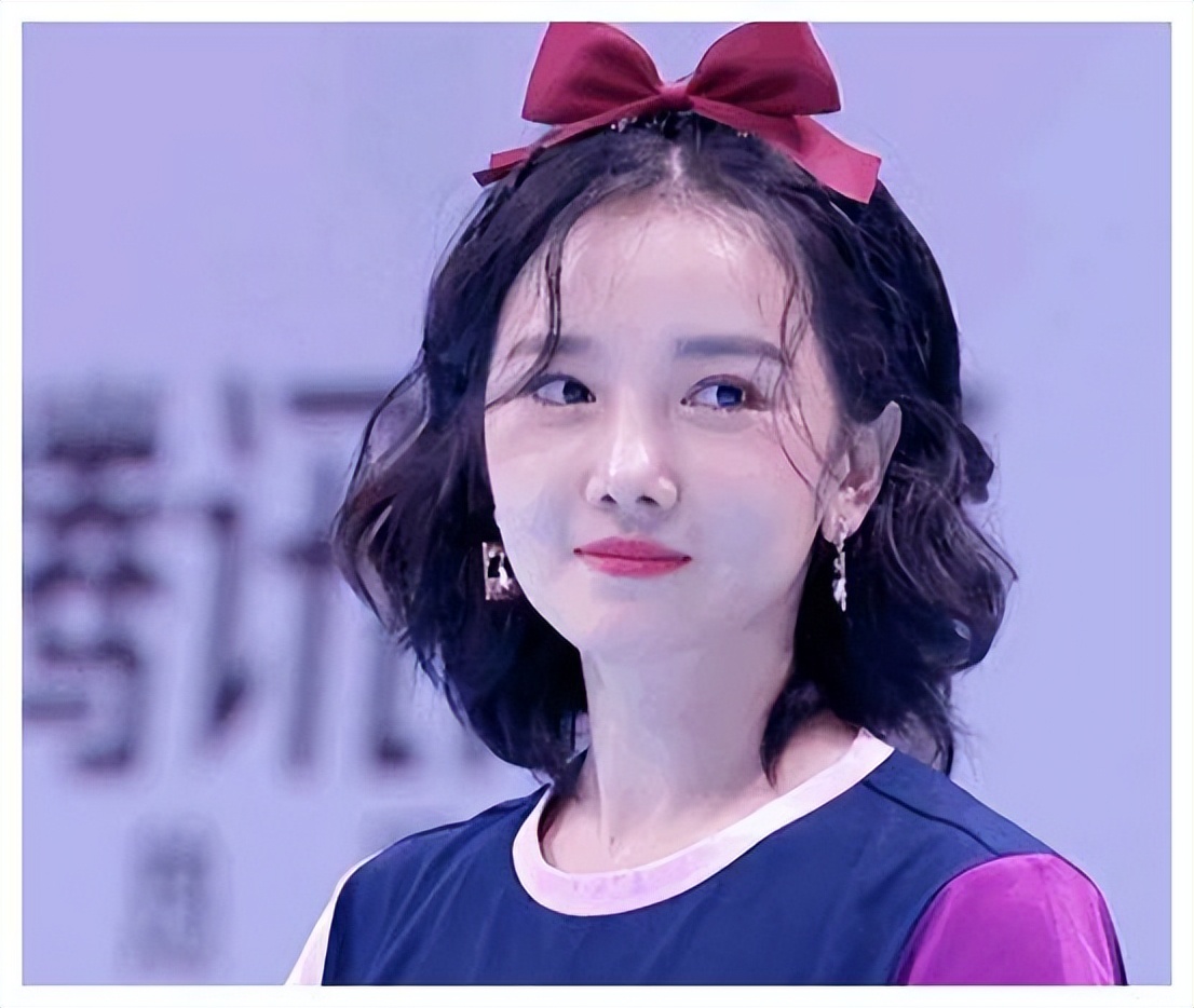 哪些明星整容后遗症越来越严重,整容明星后遗症对比图片