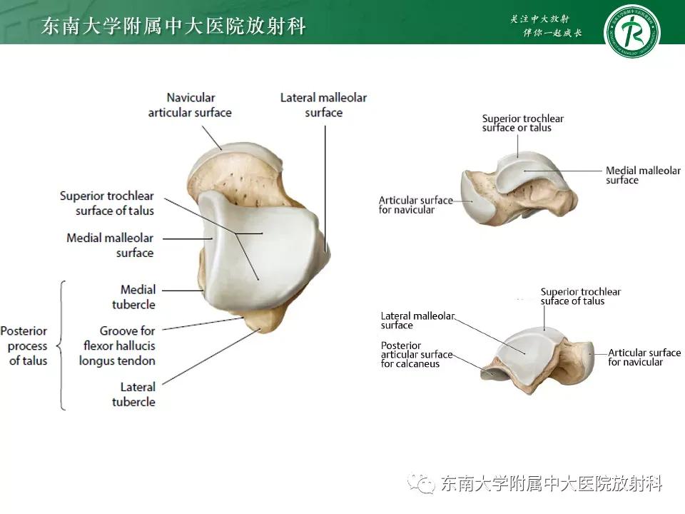 好文分享-《肌骨系统疾病——副舟骨综合征》