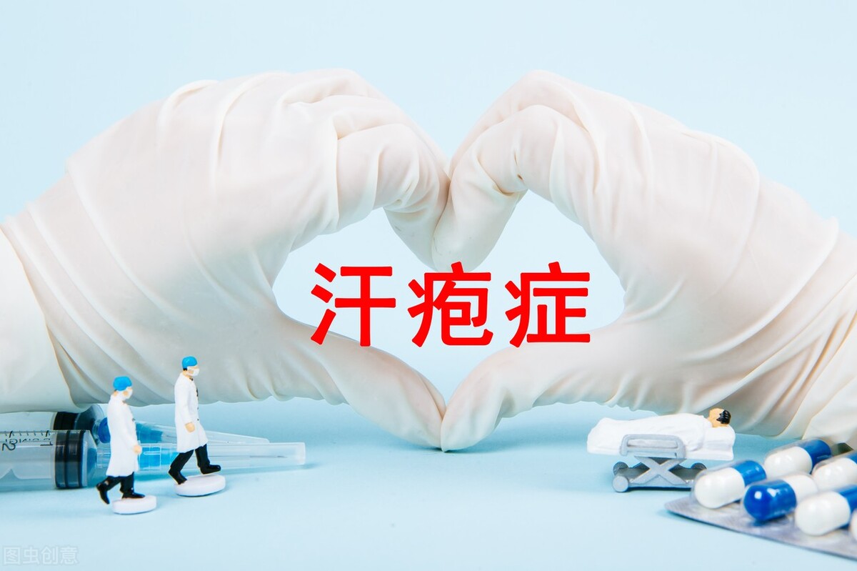 汗疱疹用什么药膏能彻底的治好了,汗疱疹怎样预防