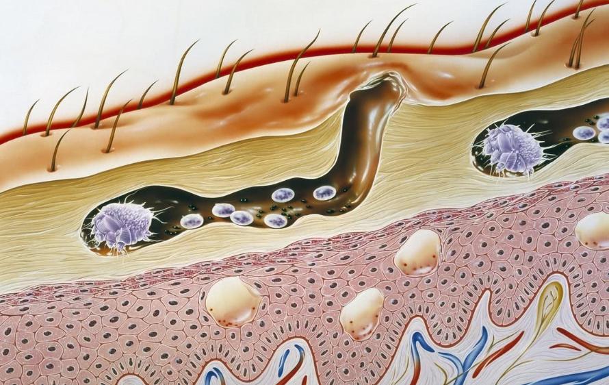 50岁男人需要补充雄激素吗,男人到中年需要补充雄激素吗