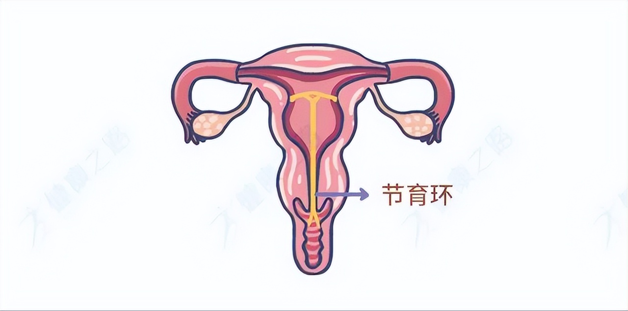 怎么样可以不吃药避孕,安全期内没有避孕措施需要吃药吗