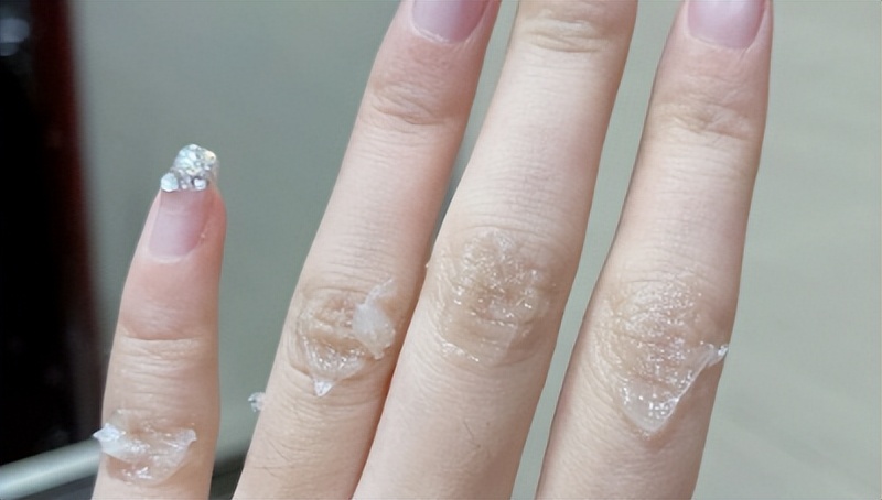 凡士林用法大揭秘,凡士林的各种妙用你知道几种