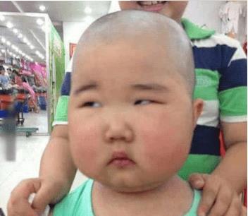 护士手术前脱毛,护士手术前剃光头