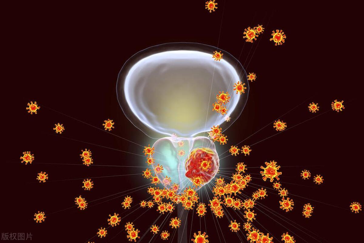 医生提醒5种疾病,医生提醒有四种习惯的人