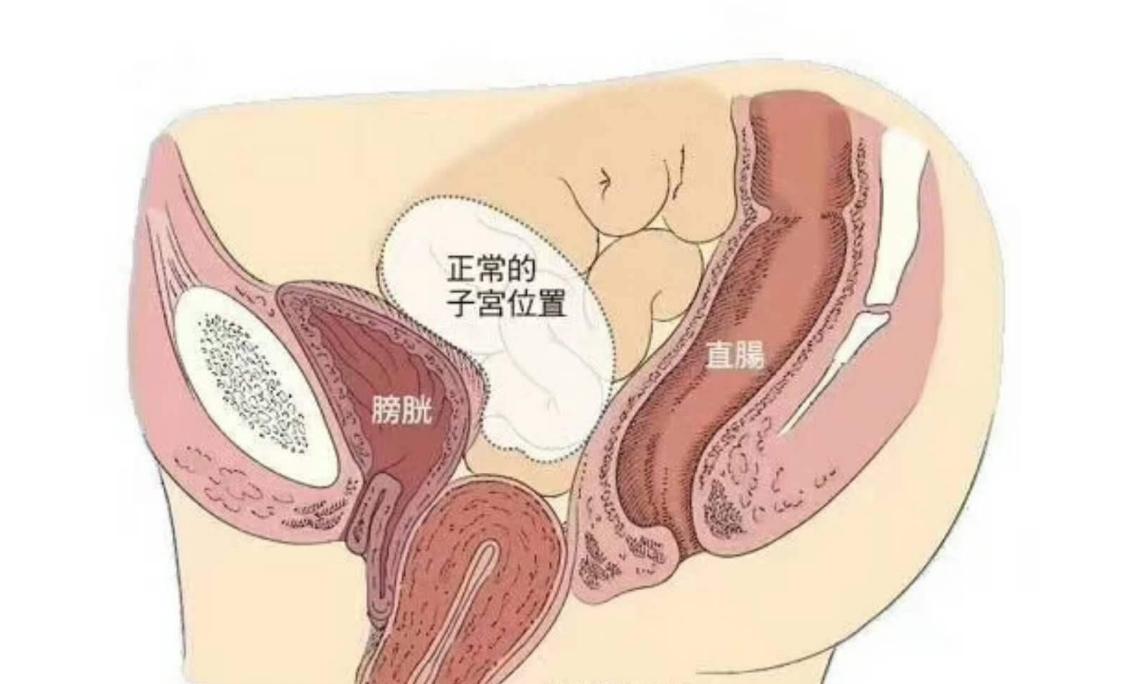 子宫里掉出小肉球,子宫内壁有肉突出来