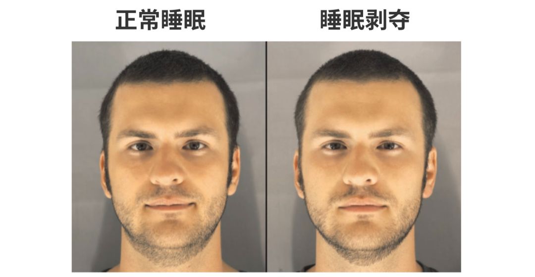 熬夜导致的衰老怎么补救,熬夜很久了怎么挽救衰老的脸