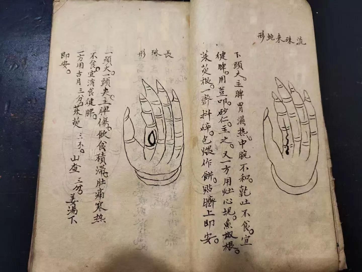 火灸疗法的书,藏医火灸疗法书