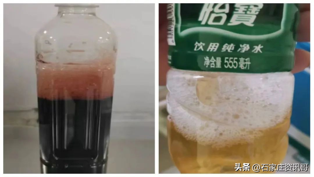 肝硬化诱发肝性脑病昏迷怎么抢救,肝硬化突发肝衰竭