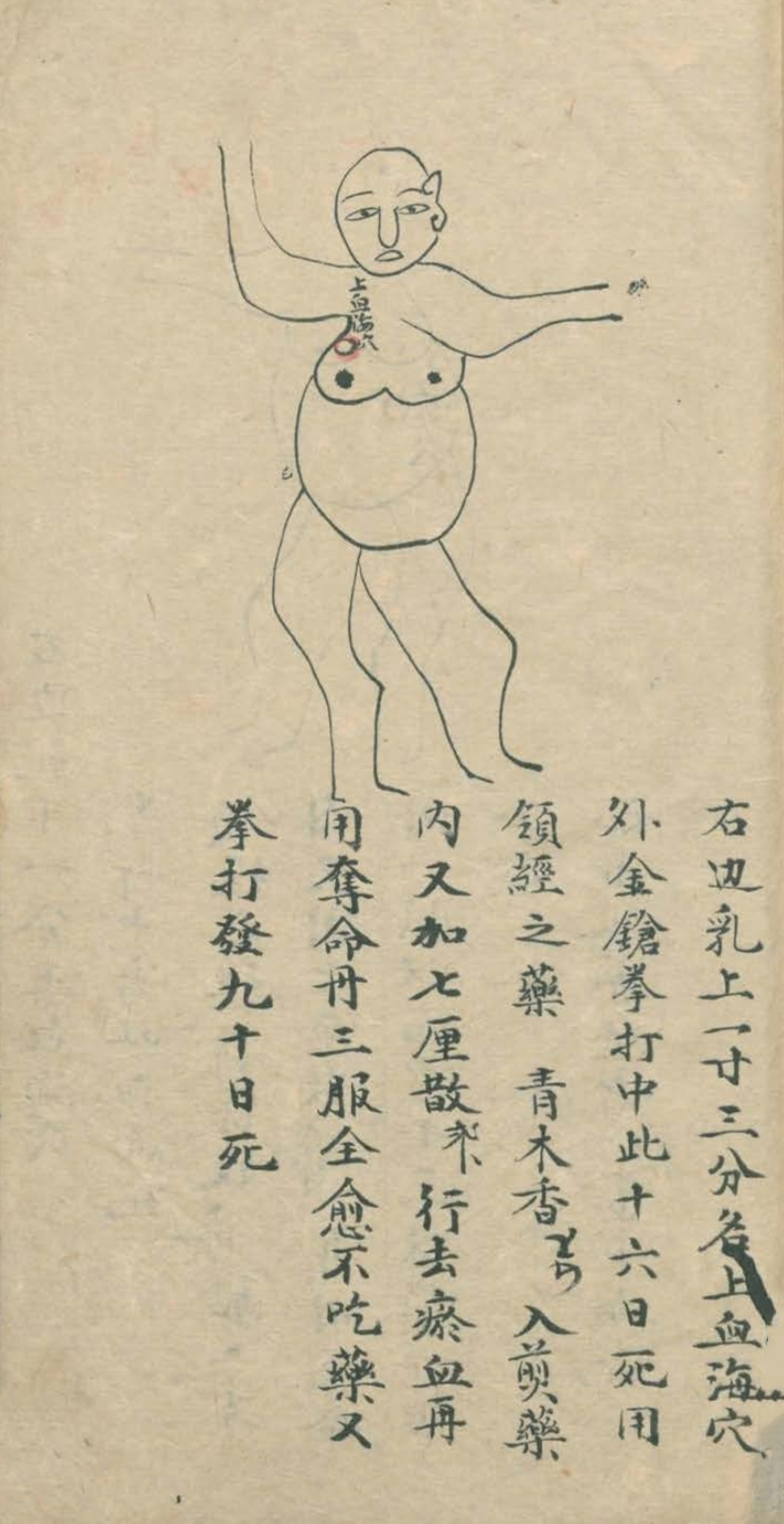 武当秘传跌打八法,民间中医古籍手抄本专医跌打秘方