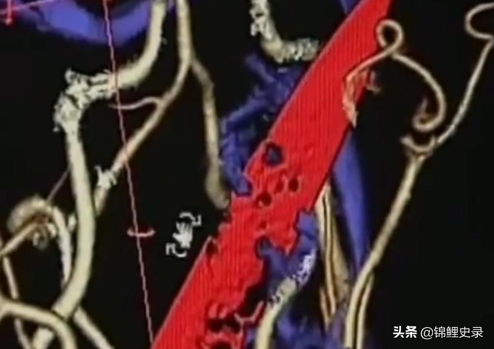 云南男子口臭骇人医生检查惊呼,云南男子口臭传奇故事