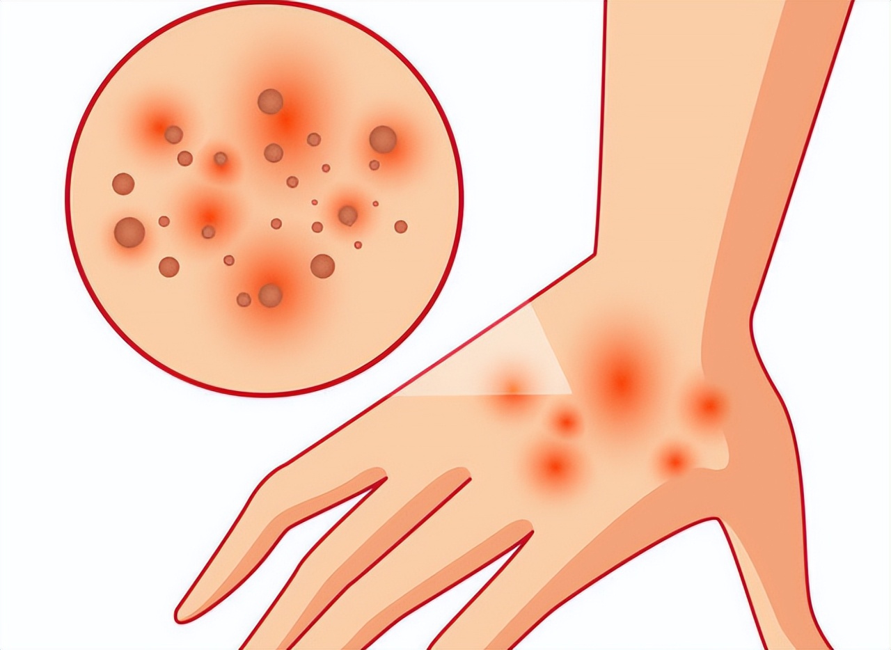 甲硝唑治牙疼也治妇科吗,甲硝唑对牙疼有治疗效果吗