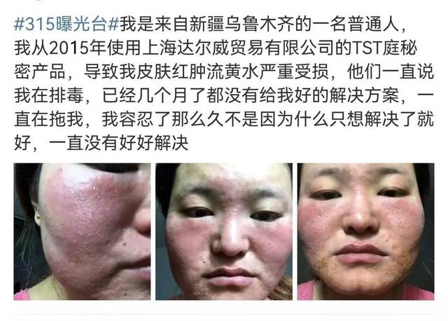 袁隆平去世，张庭偏偏大卖喜庆四件套：“面膜夫妇”的传销人生