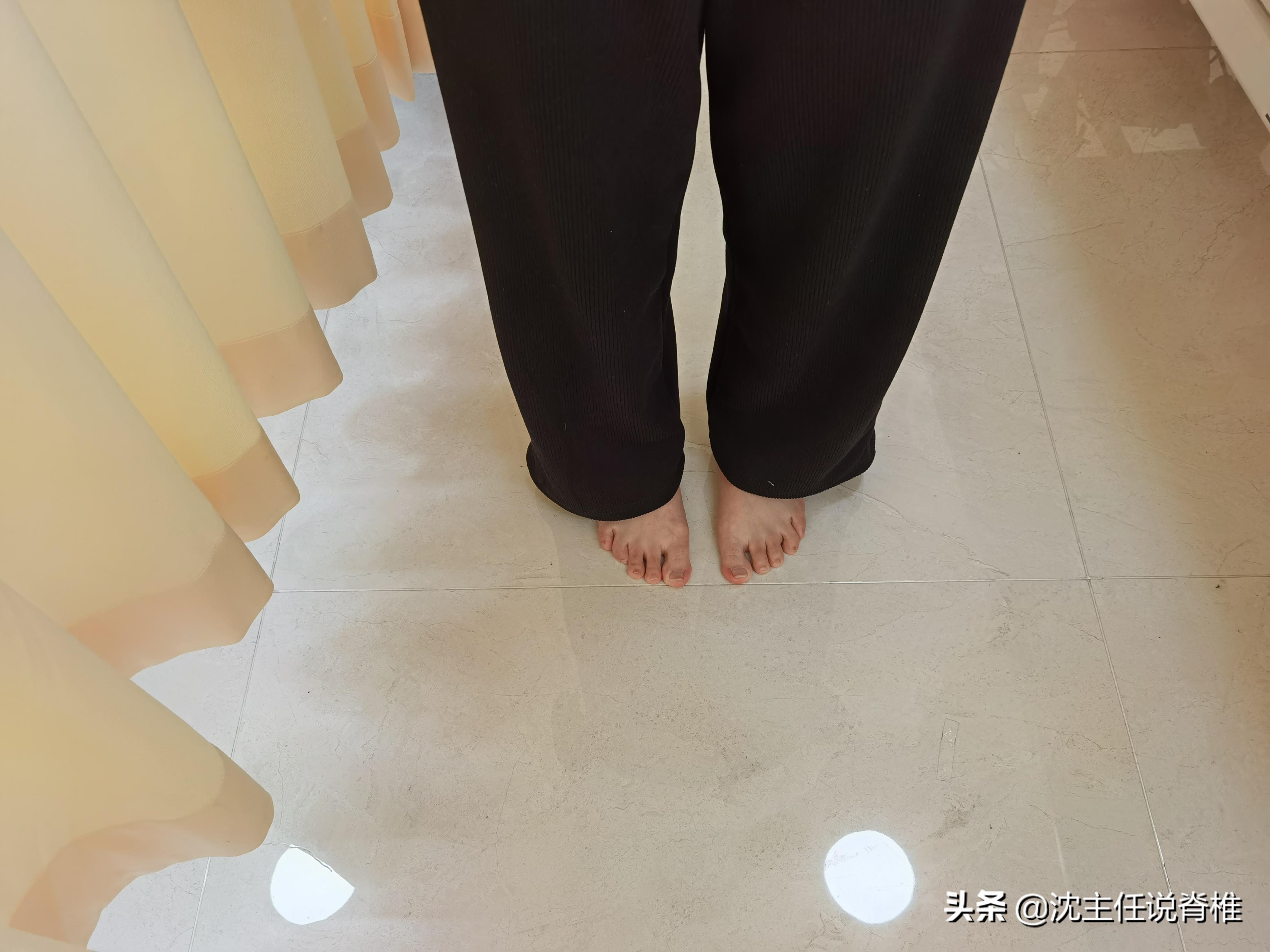 腰骶痛是不是腰突,腰骶疼是腰间盘突出吗