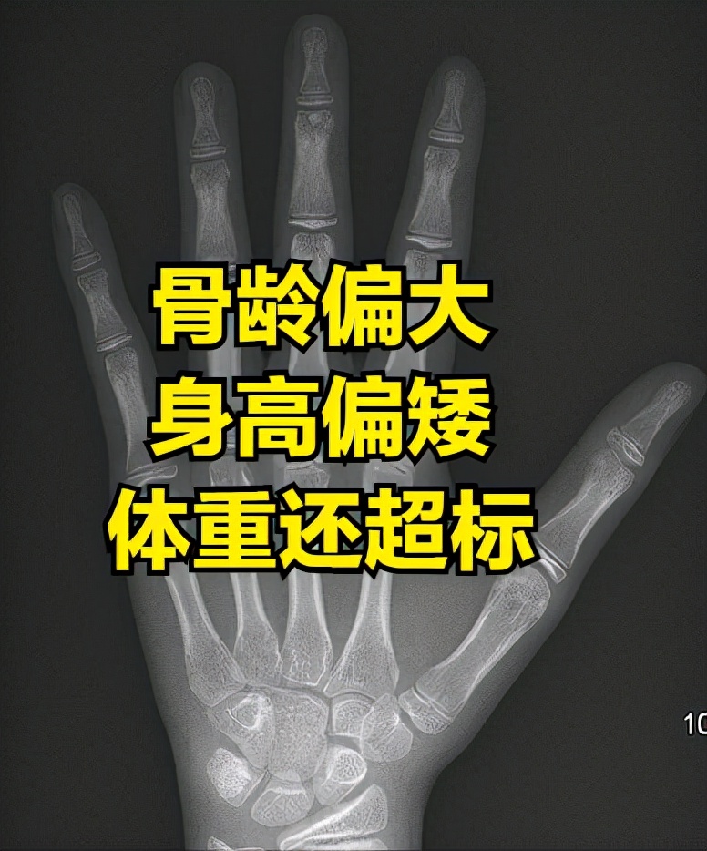 孩子身高偏矮怎么干预？怎么追赶？儿童身*干高**预的6大方案全解析