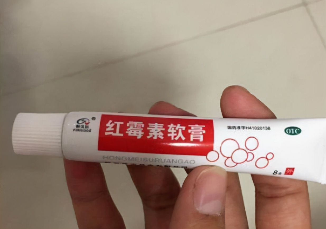 几块钱红霉素眼膏,几块钱的红霉素能用吗