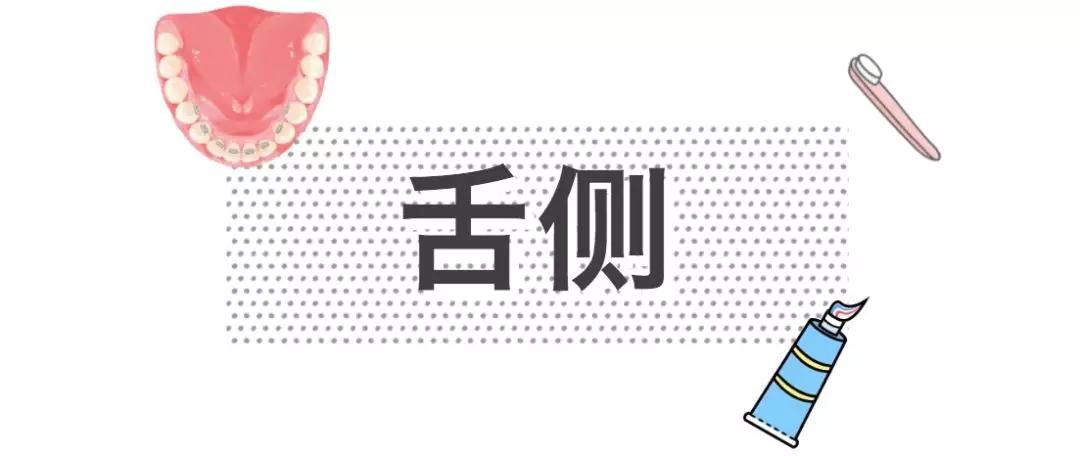 正畸金属自锁最便宜吗,正畸科金属自锁