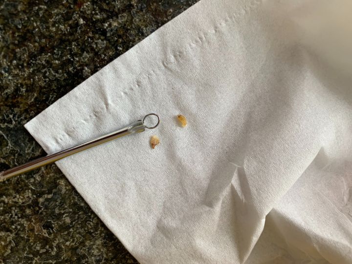 20年的黑头有多大,世界上最长的黑头到底有多长